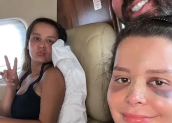 Maraisa tranquiliza os fãs, após surgir com o nariz operado nas redes sociais