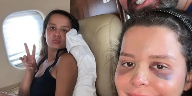 Maraisa tranquiliza os fãs, após surgir com o nariz operado nas redes sociais