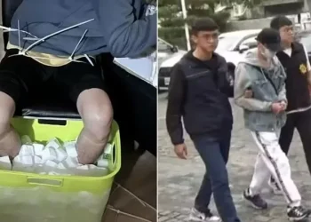 Homem amputa a própria perna para conseguir indenização de R$ 6,5 milhões