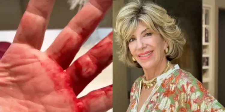 Silvia Poppovic foi atacada com mata-leão, socos e chutes em assalto