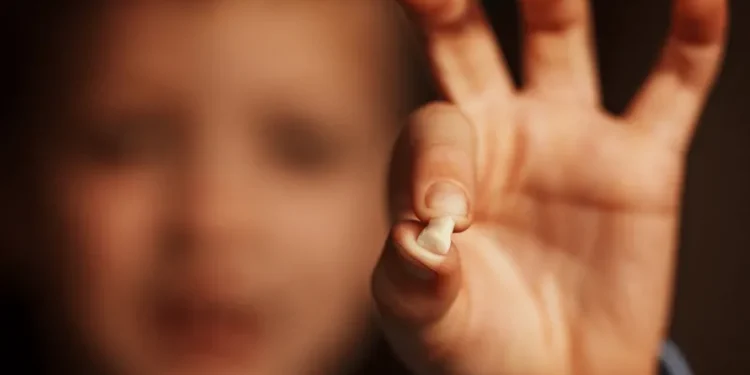 Sonhar com dente é bom ou ruim? Veja os significados