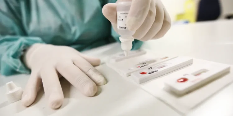 Mutirão: Fundação de Medicina Tropical oferece testagem para ISTs no sábado (6)