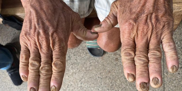 PC-AM resgata duas pessoas em condições análogas à escravidão em Presidente Figueiredo