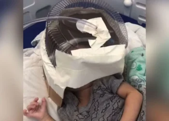 Hospital usa embalagem de bolo como máscara de oxigênio em bebê internado no RN