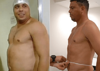 Marcio Atalla fala sobre emagrecimento de Ronaldo na TV: “Movido a desafio”