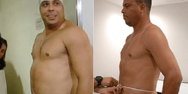 Marcio Atalla fala sobre emagrecimento de Ronaldo na TV: “Movido a desafio”