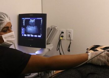 Carreta de Saúde da SES-AM começa a atender em Iranduba para realização de exames de imagens