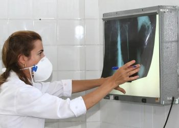 Com 408 casos em 2025, Manaus inicia campanha de combate à tuberculose