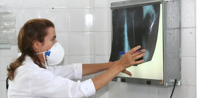 Com 408 casos em 2025, Manaus inicia campanha de combate à tuberculose