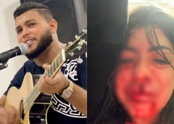 Mulher perde três dentes após agressão de cantor em Manaus