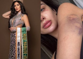 VEJA VÍDEO: Miss Amazonas denuncia ter sido espancada e ameaçada por namorado