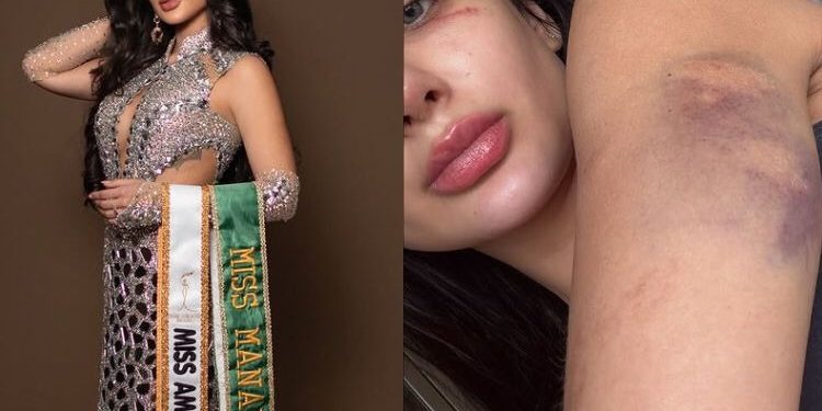 VEJA VÍDEO: Miss Amazonas denuncia ter sido espancada e ameaçada por namorado