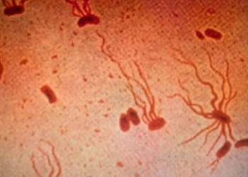 Bactéria causadora de doença fatal fica cada vez mais resistente a antibióticos