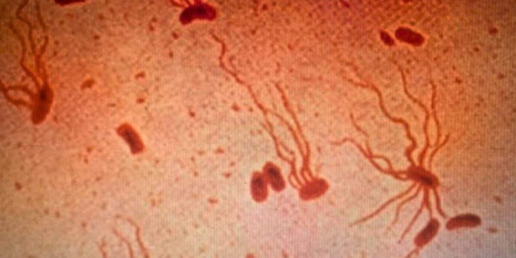 Bactéria causadora de doença fatal fica cada vez mais resistente a antibióticos