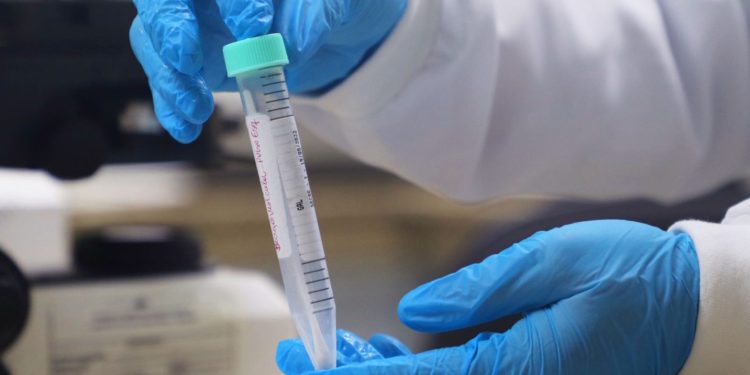 Panorama Epidemiológico da Mpox é atualizado no Amazonas, nesta quarta-feira