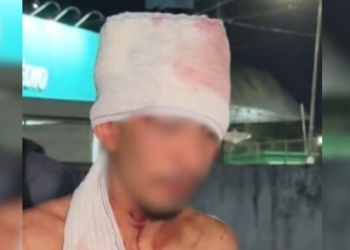 Homem invade casa em busca de comida e é espancado por moradores da área