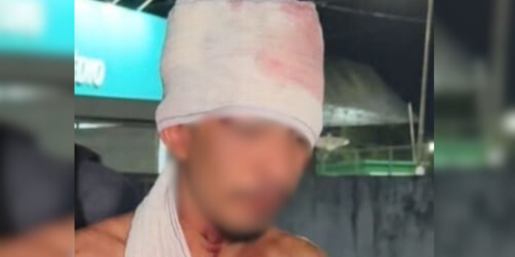 Homem invade casa em busca de comida e é espancado por moradores da área