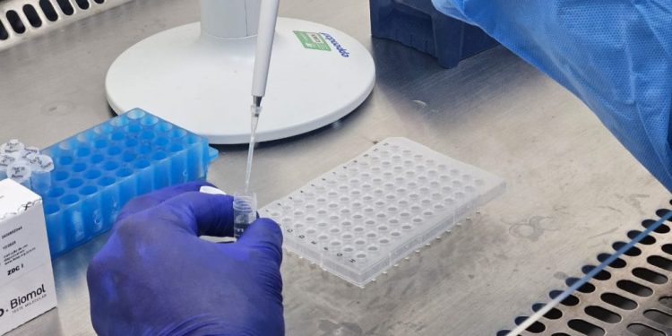 FVS-RCP registra 586 casos de SRAG causados por vírus respiratórios no AM em 2025