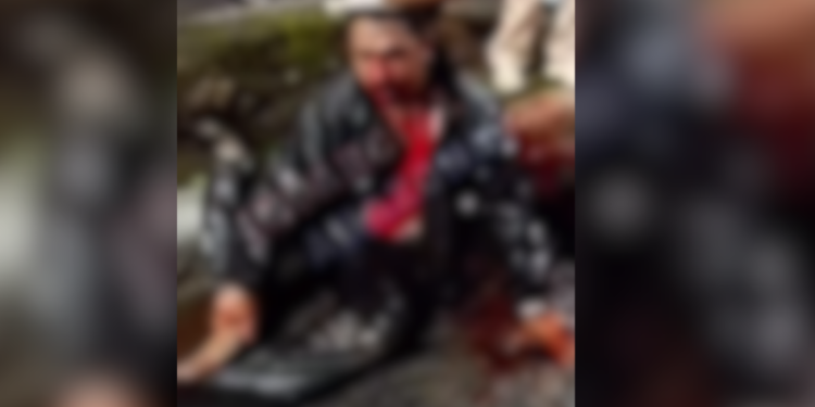 Vídeo: Motociclista fica ferido após acidente no bairro Distrito Industrial