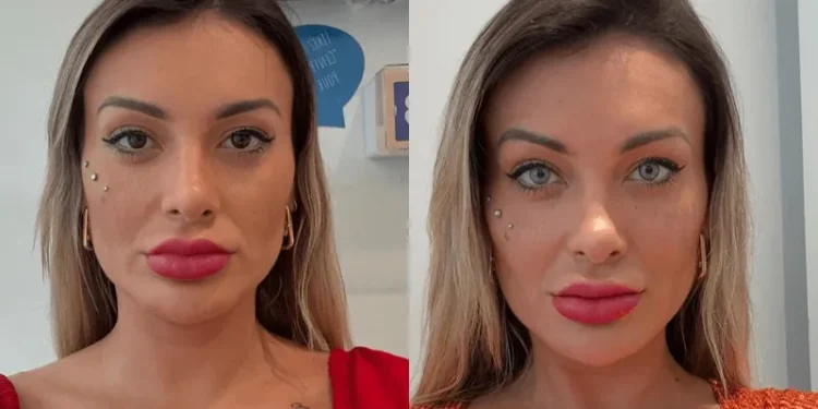 Cirurgia feita por Andressa Urach para mudar cor dos olhos é proibida no Brasil; entenda