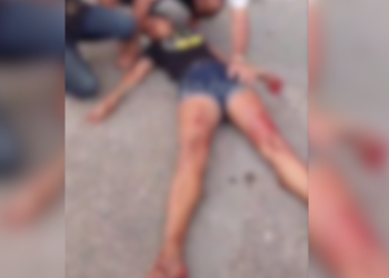 Mulher é baleada em via pública na avenida Grande Circular