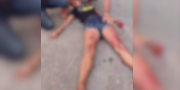 Tentativa de homicídio: mulher é baleada na avenida Grande Circular