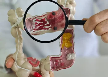 Em 13 anos, doença inflamatória intestinal cresce 5 vezes no Brasil