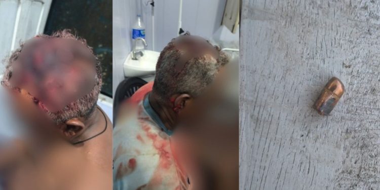 Liderança de 67 anos é baleada em vigilância no AM; quatro são presos